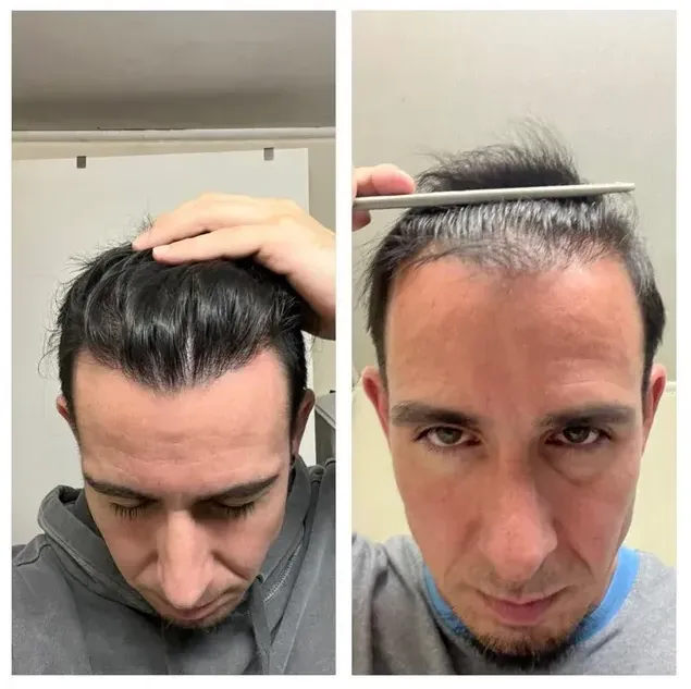 Verified customer Jim Williams reviewing Happy Head hair growth